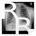 Radiology Cases: Chest‏ Mod