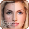 Face Blemishes Removal Mod Apk 1.5 [Remover propagandas][Compra grátis][Sem anúncios]