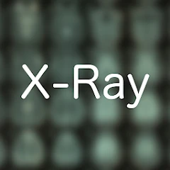 X-Ray Differential Diagnosis Mod Apk [Free purchase][Mod speed]