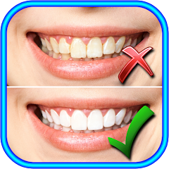 How to Whiten Teeth at home Mod