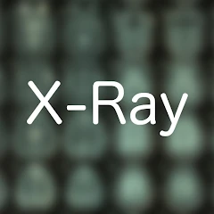 X-Ray Differential Diagnosis Mod Apk [Free purchase][Mod speed]