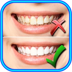 How to Whiten Teeth at home Mod Apk [Free purchase][Mod speed]